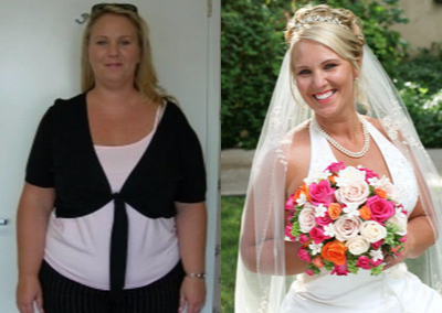 25-34 year old woman treated with Lap Band - Pre-Op Weight: 253 lbsTotal Weight Loss: 100 lbs