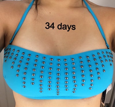 No more deflated breasts! 32C, 360cc, 110lbs, round, high profile