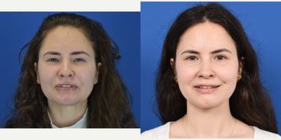 Facial Reconstructive Surgery - Facial Reconstructive Surgery