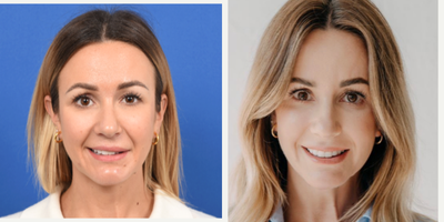 Facial Reconstructive Surgery - Facial Reconstructive Surgery