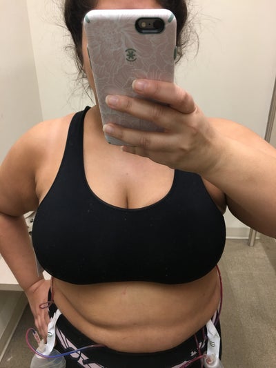 5'3 196lbs 38DDD or Slightly Larger Going to a C/D - Review - RealSelf