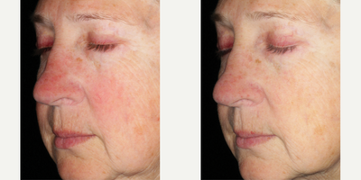 Skinbetter Science - Alto Defense Serum.Photo provided courtesy of Skinbetter Science.