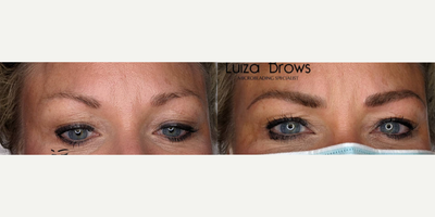 Woman treated with Microblading - Woman treated with Microblading