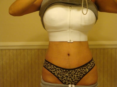 Lift with Small Reduction. 32FF Saggy to 32DD Perky! - Ontario, ON