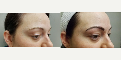 25-34 year old woman treated with Permanent Makeup - MicroBlading Before and After pictures by Dr. Deborah Sillins of Rejuvene Plastic Surgery in Northern Kentucky and Cincinnati.