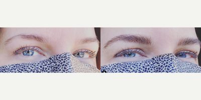 Woman treated with Permanent Makeup - Permanent Makeup