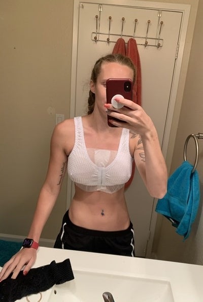 20 Years Old, 5'2 and 112lbs, 32F - Review - RealSelf
