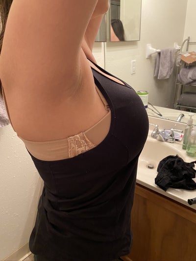 Breast Reduction!! 22 Yrs, 34G, 130 Lbs, 5'2 - Review - RealSelf