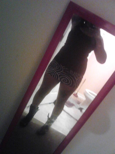 Dra Baez Lipo Bbl Australia Fragoso Baez Md Review Realself