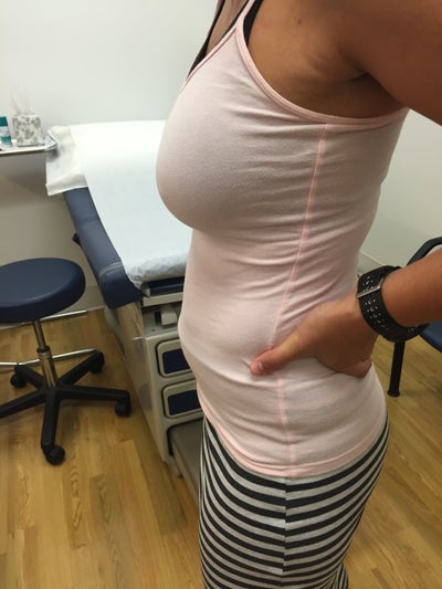 5ft 11in 160lbs. 34b to 34D!Mom of 2. - Review - RealSelf