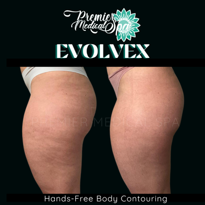 Evolve before and after photo