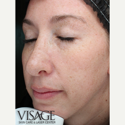 visage laser & skin care center