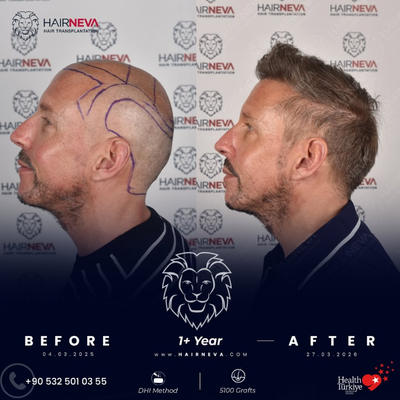 before and after image