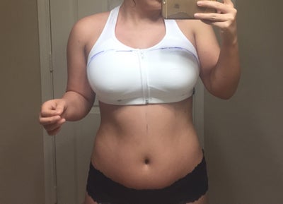From 36b to 36d 397 Mod+ Part 2 (4 mo post op) - Review - RealSelf