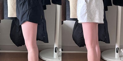 25-34 year old woman treated with Lipodissolve - Fat-dissolving injections to contour the thighs