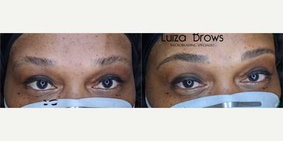 Woman treated with Microblading - Woman treated with Microblading