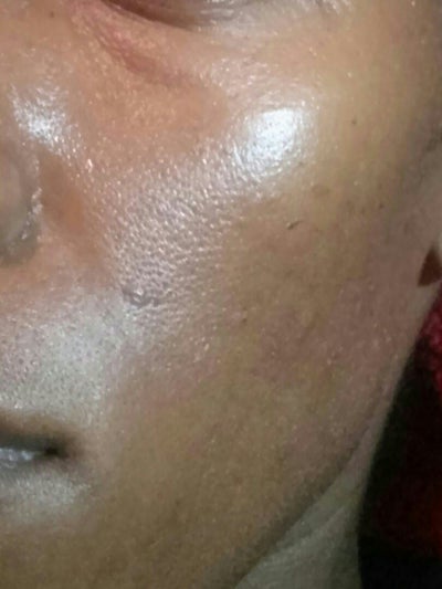 Which facial skin treatments would be best for my skin ...