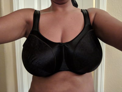Insurance Approved!!!!!!!!38F I've Wanted A Breast Reduction For