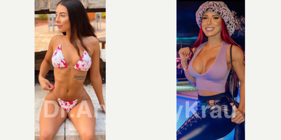 18-24 year old woman treated with Breast Augmentation - 520ccs with GalaFLEX