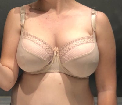 Breast reduction 26yo: from 36GG to 36B - Review - RealSelf