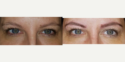 35-44 year old woman treated with Permanent Makeup - MicroBlading Before and After pictures by Dr. Deborah Sillins of Rejuvene Plastic Surgery in Northern Kentucky and Cincinnati.