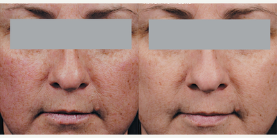SkinCeuticals, Discoloration Defense - Discoloration Defense. Photo provided courtesy of SkinCeuticals