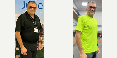 Man treated with Gastric Bypass - Man treated with Gastric Bypass.