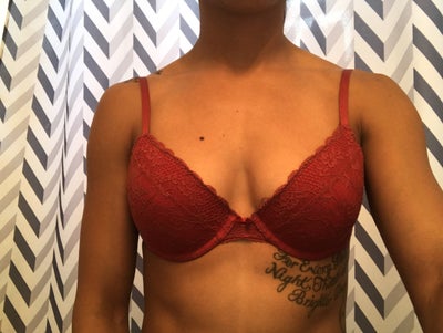 Mom of 3 AA cup 275cc & 335cc implants - Review - RealSelf