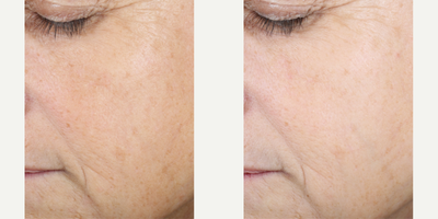 Skinbetter Science - Even Tone Correcting Serum.Photo provided courtesy of Skinbetter Science.