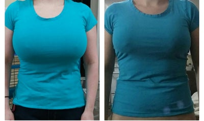 48 Years Old. Pre op breast size: 38L. Canada - Review - RealSelf