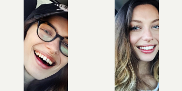 Straighten your teeth without braces - Photo provided courtesy of SmileDirectClub.