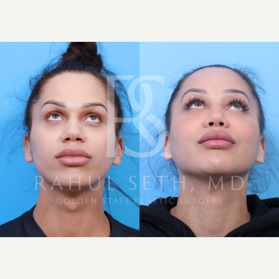before and after image