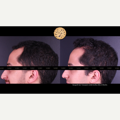 before and after image