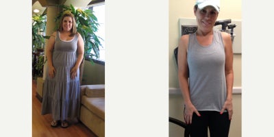 35-44 year old woman treated with Lap Band - Pre-Op Weight: 212 lbsTotal Weight Loss: 81 lbs
