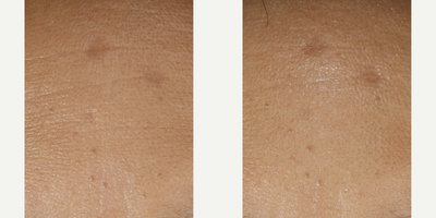 Skinbetter Science - Trio Rebalancing Moisture Treatment.Photo provided courtesy of Skinbetter Science.
