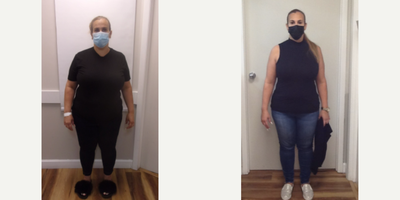 25-34 year old woman treated with Orbera Gastric Balloon - Weight 230 lbs. BMI 43.5Weight 189.7 lbs. BMI 34.7The patient lost 40 pounds in 5 months!