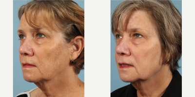 Obagi - Obagi Nu-Derm