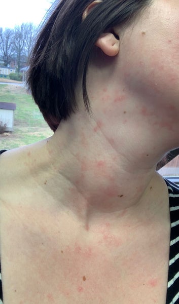 Tripeptide-R Neck Repair
