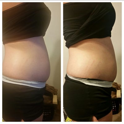 Do Body Wraps Work for Weight Loss or Cellulite? - RealSelf