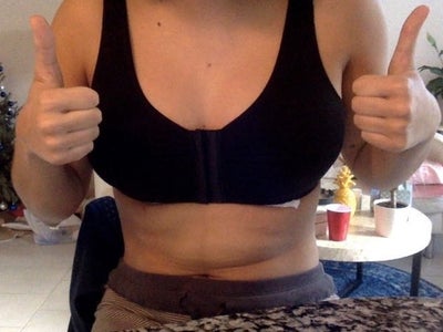 33, Mom of 2, Reduction 34DDD to a 34C - Review - RealSelf