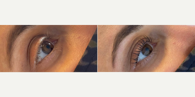 Woman treated with Lash Lift - Woman treated with Lash Lift.