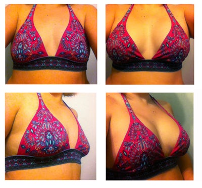 36 F After Breast Augmentation