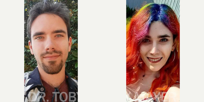 Transgender woman treated with Transgender Facial Feminization Surgery - Transgender woman treated with Transgender Facial Feminization Surgery