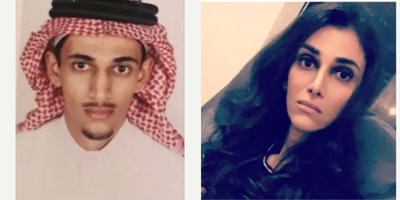 25-34 year old woman treated with Facial Feminization Surgery - 25-34 year old woman treated with Facial Feminization Surgery