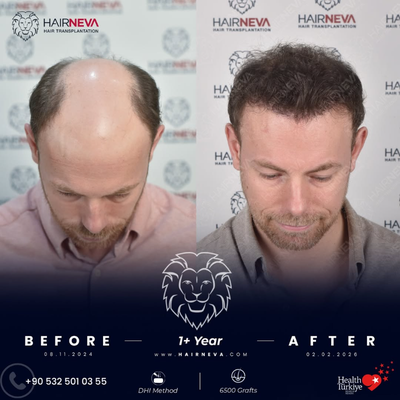 before and after image