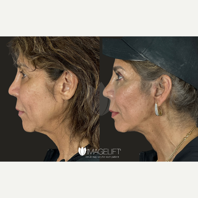 before and after image