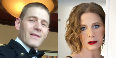 45-54 year old transgender woman treated with Facial Feminization Surgery, Adam's Apple Reduction, Brow Bone Reduction, Rhinopla - Transgender woman who underwent FFS (brow lift, orbital rim contouring, frontal bar reduction, rhinoplasty, genioplasty, gonial angle reduction, tracheal shave).