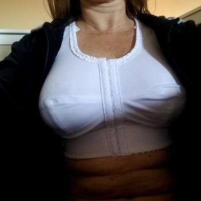 5'3 32G Hoping to Become 32C - Review - RealSelf