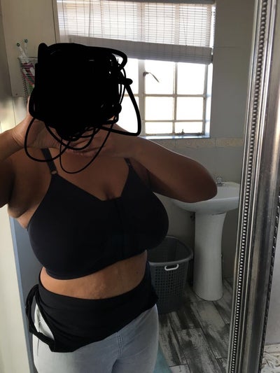 From a 36E to a Full B or Small C Cup - Review - RealSelf