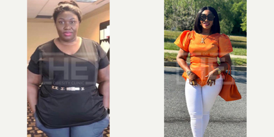 25-34 year old woman treated with Gastric Bypass - She lost more than 40 KG with Gastric Sleeve Surgery at Dr HE Obesity Clinic in Turkey.